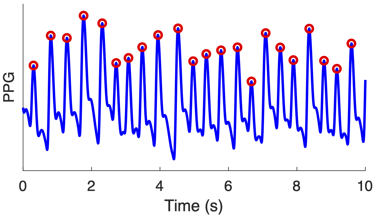 PPG signal and detected beats